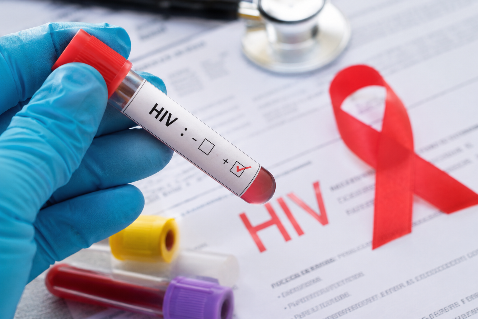 1.170 Warga Riau Positif HIV Sepanjang 2025